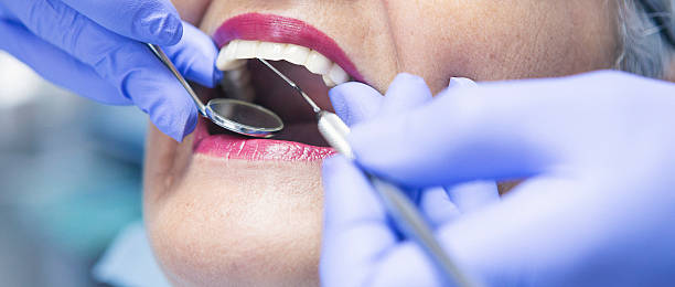 Best Emergency Treatment for Oral Infections in Lompoc, CA